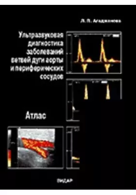 Ультразвуковая диагностика заболеваний ветвей дуги аорты и периферических сосудов. Атлас