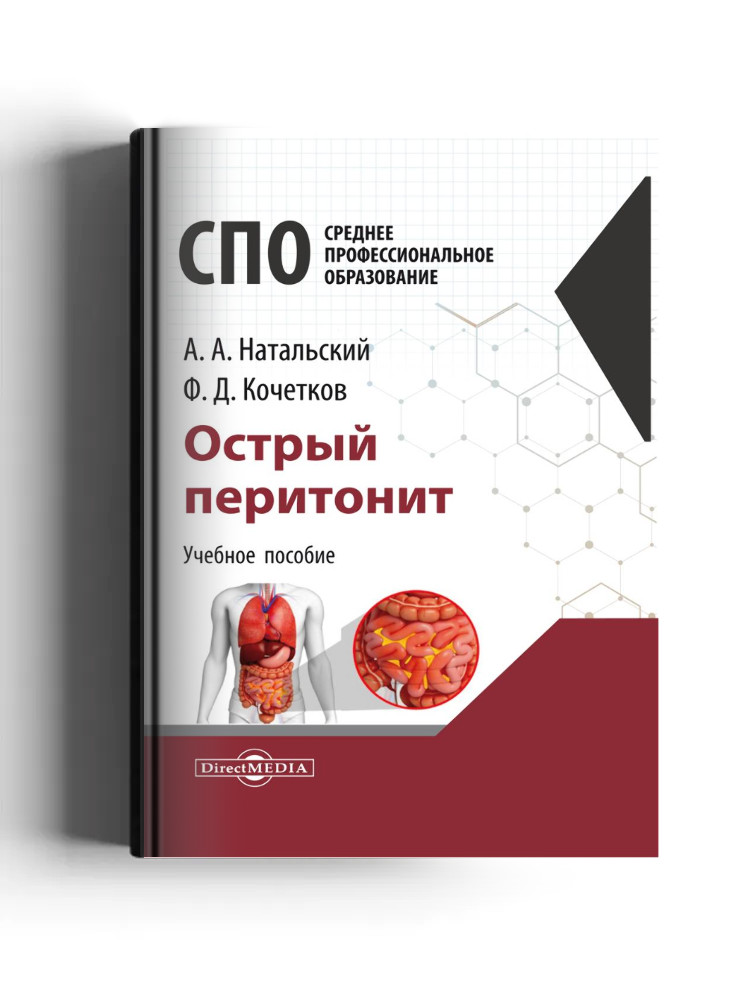 Острый перитонит